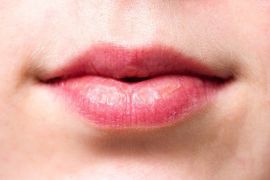 Wrinkles Above the Lips: The Best Treatments & Prevention